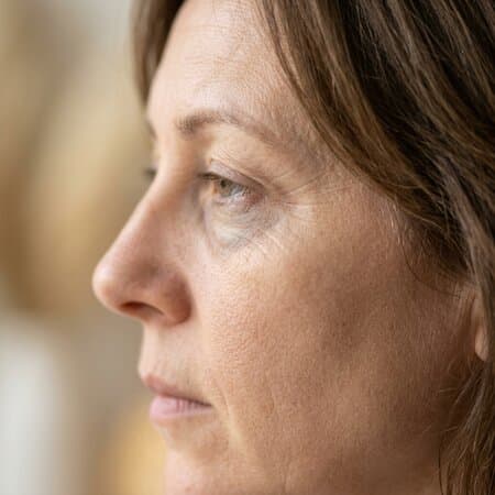 Dehydrated, tired-looking skin